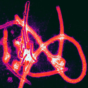 "Ebola virus particles" by Thomas W. Geisbert, Boston University School of Medicine - PLoS Pathogens, November 2008 direct link to the image description page doi:10.1371/journal.ppat.1000225. Licensed under Creative Commons Attribution 2.5 via Wikimedia Commons 